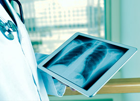 放射線療法（イメージ）